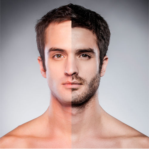 Facial Hair Restoration in New Jersey
