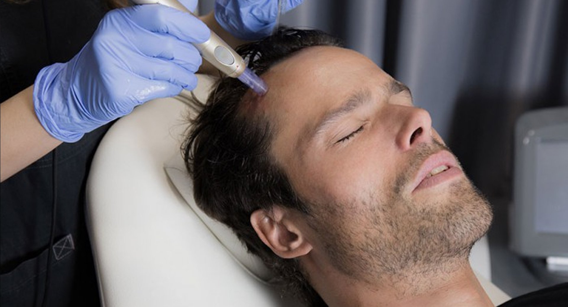 dermapen-capilar-3_1024x1024@2x